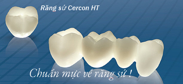 Răng Sứ Cercon sử dụng được bao lâu, bền không