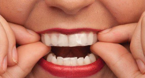 Tẩy Trắng răng An Toàn Hiệu quả tại nhà bằng Máng Tẩy Trắng răng Hiệu quả kém hơn tại phòng khám