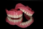Làm răng giả Tháo lắp là gì? Nên làm răng giả tháo lắp hay cấy ghép Implant