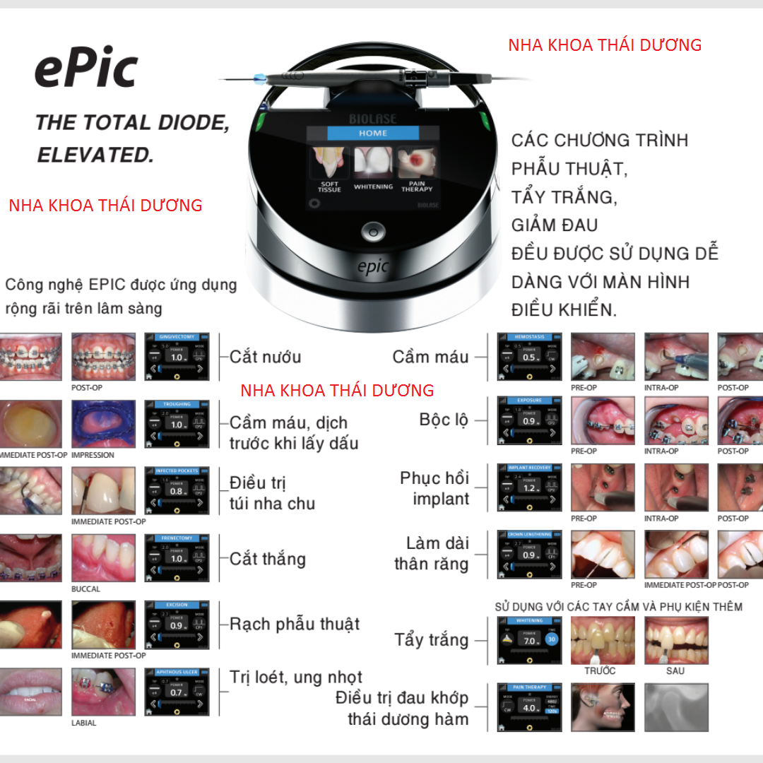 Ứng Dụng Laser EPIC Biolase Điều Trị Các Bệnh Lý Nha Khoa