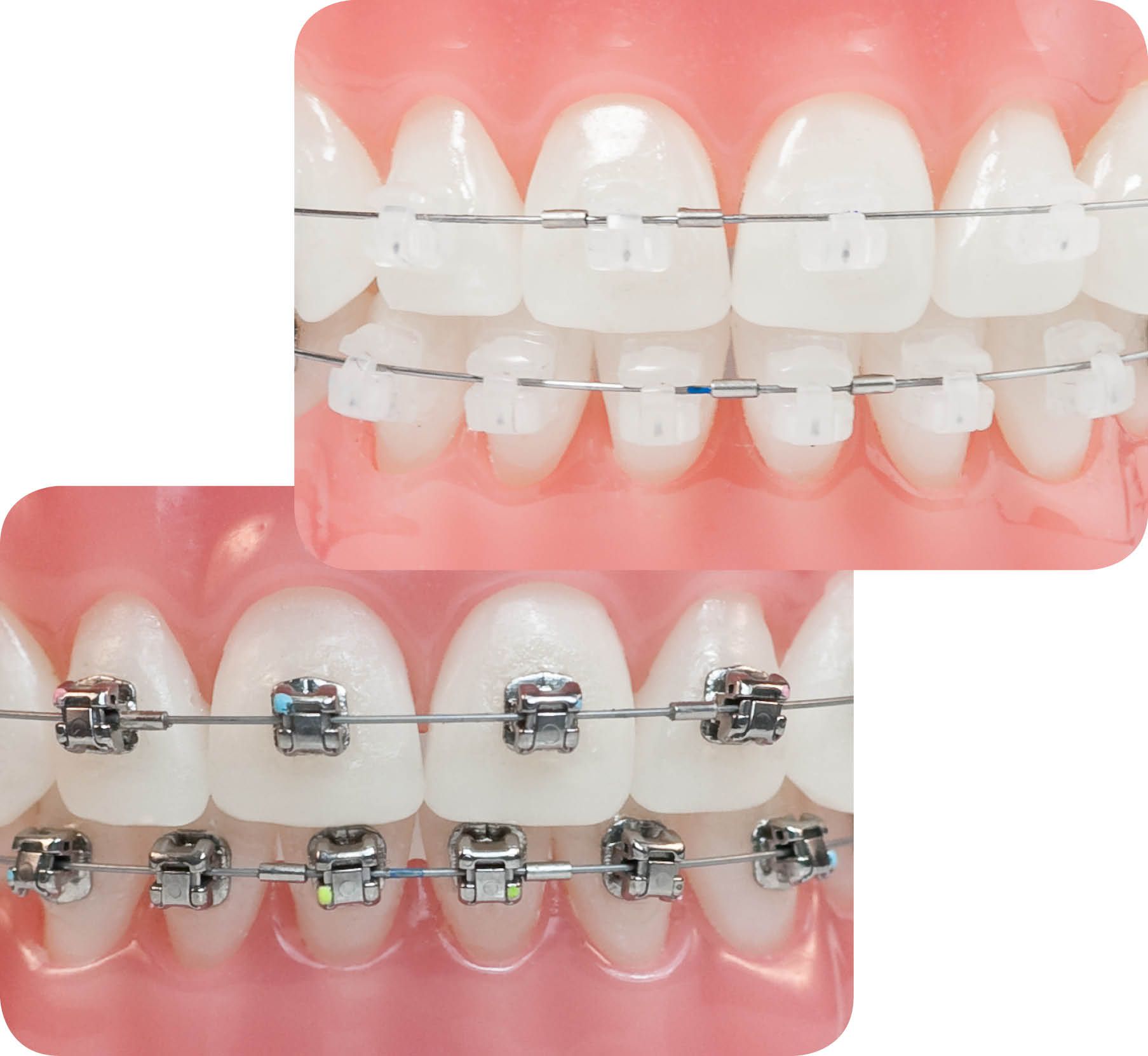 Niềng răng tốt nhất uy tín nhất TPHCM