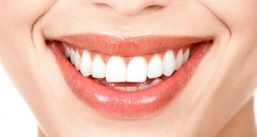 Hình Minh Họa Niềng Răng Không Mắc Cài Invisalign giá bao nhiêu là RẺ nhất và Kết Quả Niềng Răng Sau khi niềng đẹp Thẩm Mỹ cao