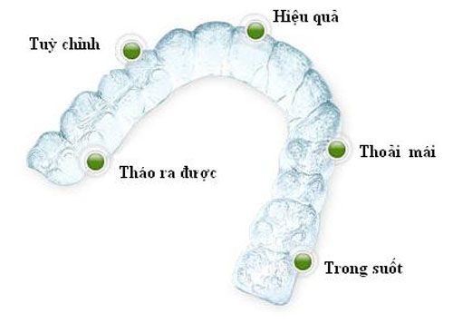 Khay Niềng Răng Không mắc cài Invisalign an toàn với sức khỏe, hiệu quả thẩm mỹ cao