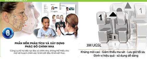 Vi tính hóa bằng phần mềm Phân tích Niềng răng