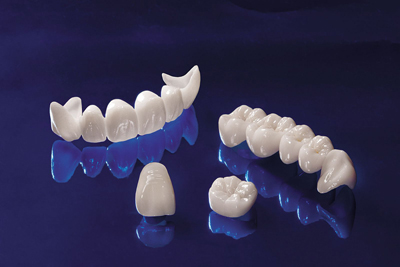 Răng Sứ Cercon Thẩm Mỹ Toàn sứ Tốt nhất, đẹp nhất