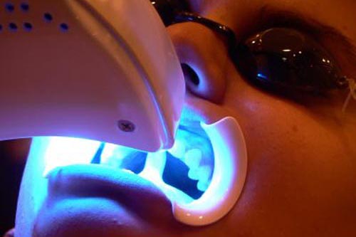 Tẩy Trắng Răng An Toàn Hiệu quả nhất bằng đèn Laser trong lúc Thực hiện Tẩy Trắng Răng Tại Phòng Khám Nha Khoa Tẩy Trắng Răng An Toàn Hiệu quả nhất bằng đèn Laser trong lúc Thực hiện Tẩy Trắng Răng Tại Phòng Khám Nha Khoa
