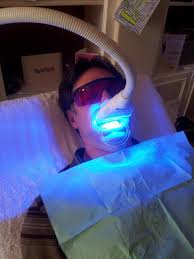 Tẩy trắng răng Lazer